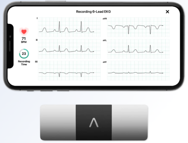 KardiaMobile 6L AliveCor