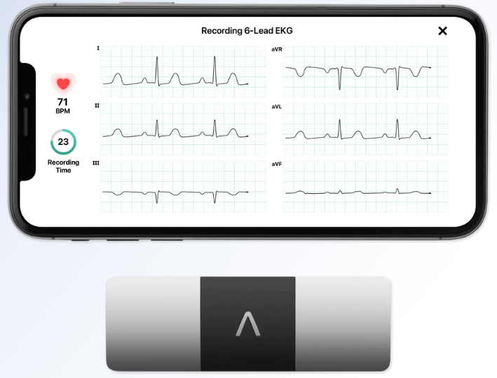 EKG Monitor with 6 Leads  KardiaMobile 6L by AliveCor – AliveCor, Inc.