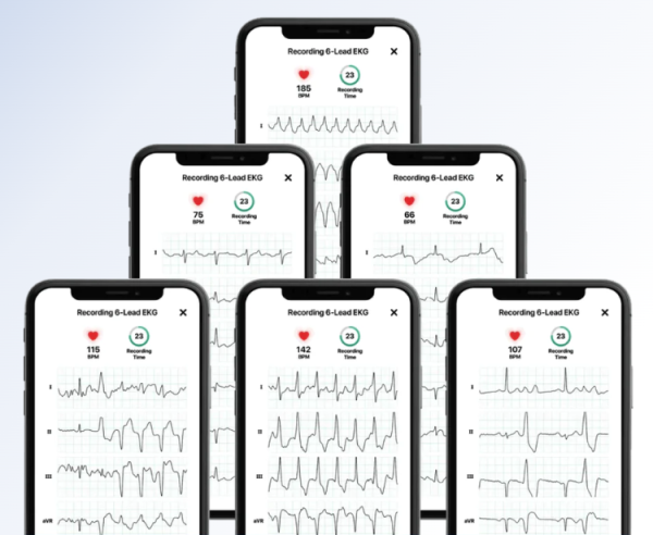 KardiaMobile 6L AliveCor